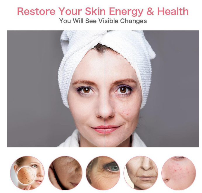 Microcurrent RF Facial Beauty Device